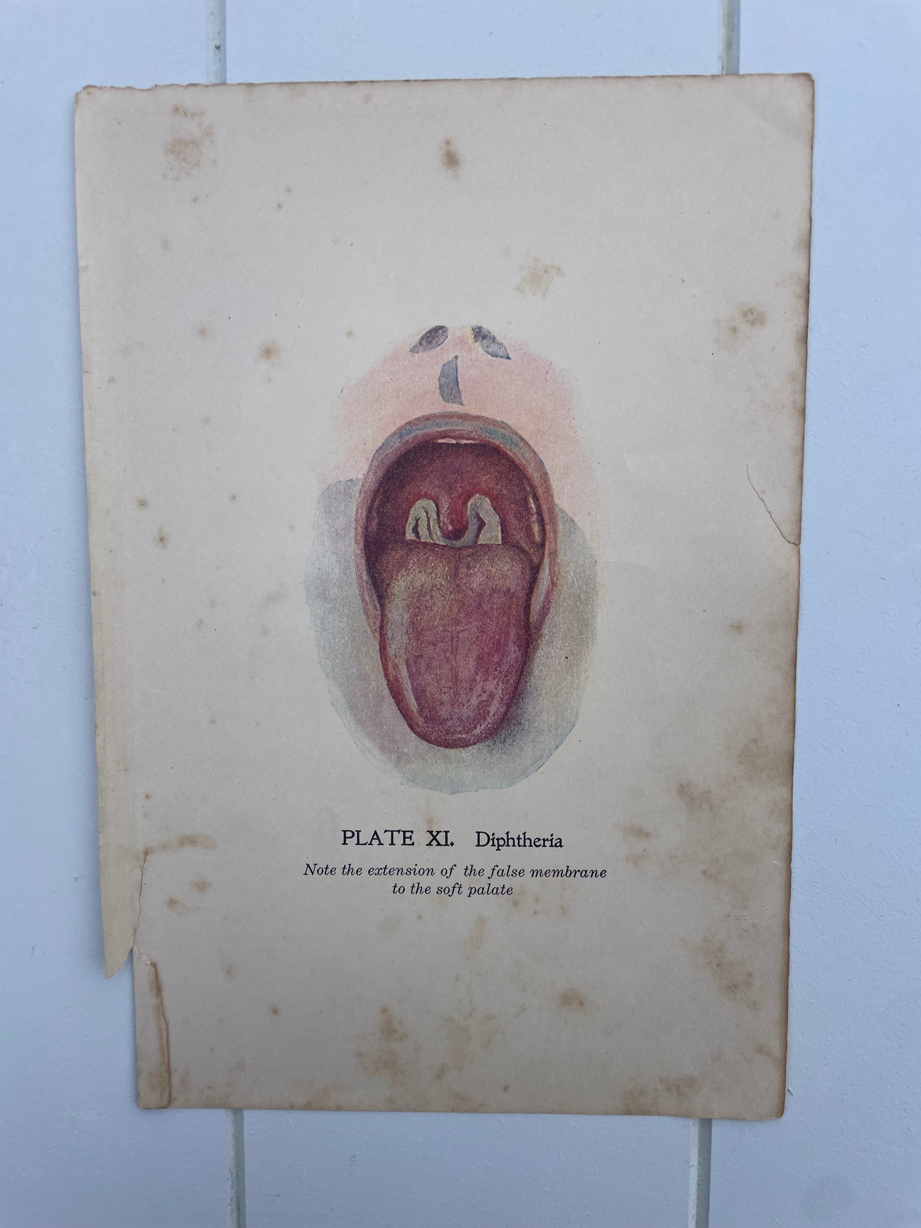 Antique Medical Plates