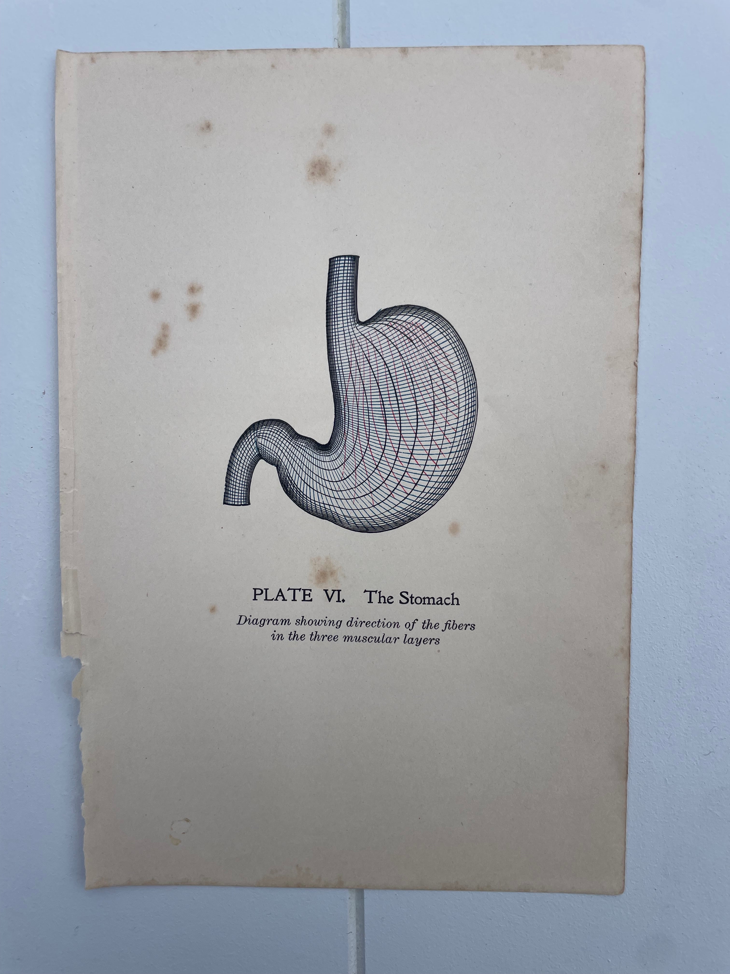Antique Medical Plates