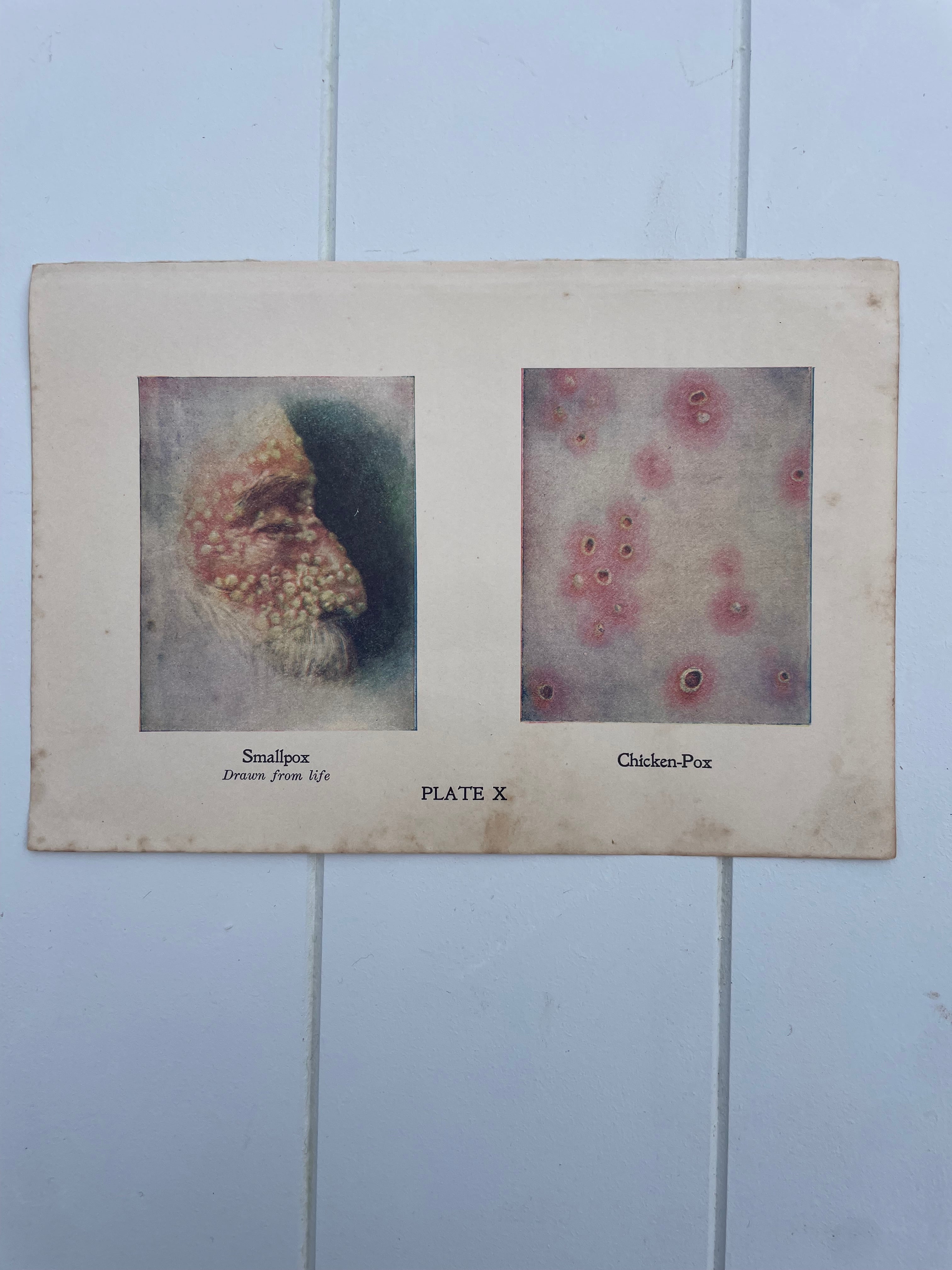 Antique Medical Plates