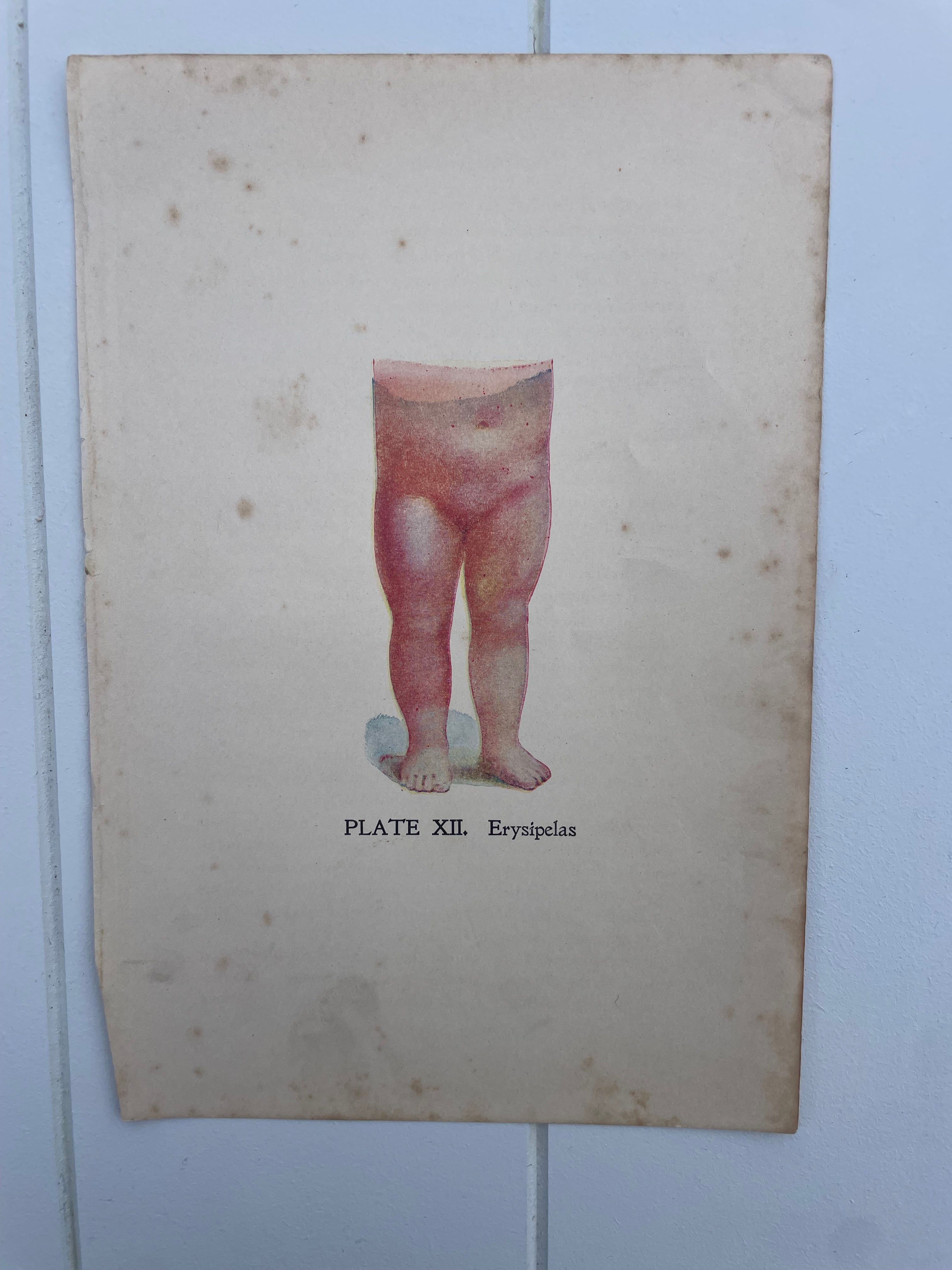 Antique Medical Plates