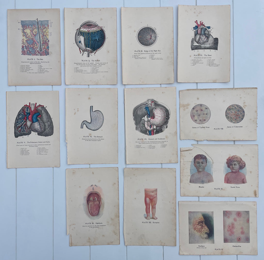 Antique Medical Plates